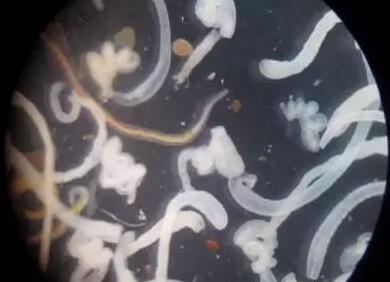 开水烫三次都杀不死的虫子 不用净水器过滤还能用什么？