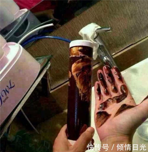 净水器为身体拦截什么? 你知道多少？