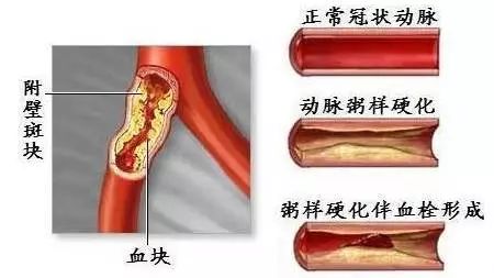 水质决定体质 好水决定寿命