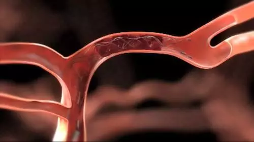 血管的“寿命” 多半由你怎么喝水决定的