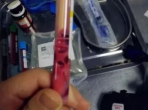 不爱喝水?小心这种“要命”的疾病找上你!